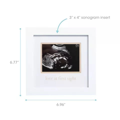 Marco de fotos blanco para ecografía 3x4, diseño 'amor a primera vista'